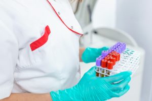 Lab Test Errors And Their Legal Implications 300x200