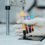 Failure to Order Proper Tests: Can You Sue?